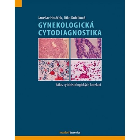 Gynekologická cytodiagnostika - Atlas cytohistologických korelací