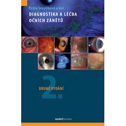 Diagnostika a léčba očních zánětů