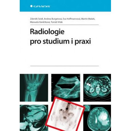 Radiologie pro studium i praxi