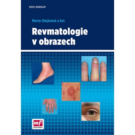 Revmatologie v obrazech