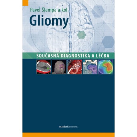 Gliomy - Současná diagnostika a léčba