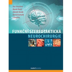 Funkční stereotaktická neurochirurgie