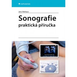 Sonografie - praktická příručka