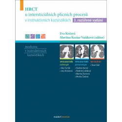 HRCT u intersticiálních plicních procesů v instruktivních kazuistikách