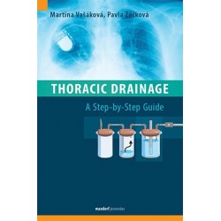 Thoracic Drainage / A Step-by-Step Guide