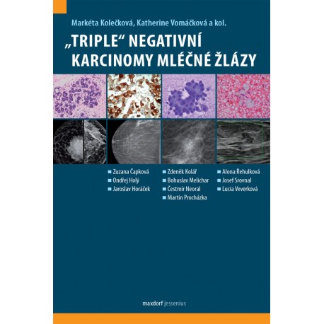 „Triple“ negativní karcinomy mléčné žlázy